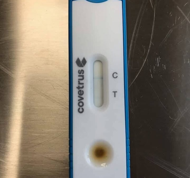 Giardia / Lamblia 🩺🦠
Pasożytniczy pierwotniak wywołujący biegunkę.