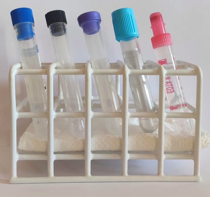 ♦️ W naszym laboratorium wykonujemy:
~ badanie…